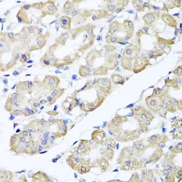 Anti-CCDC52 antibody used in IHC (Paraffin sections) (IHC-P). GTX55552