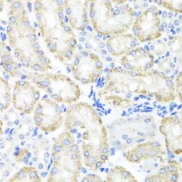 Anti-CCDC52 antibody used in IHC (Paraffin sections) (IHC-P). GTX55552