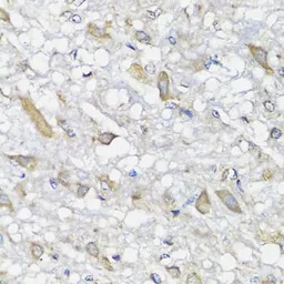 Anti-CCDC52 antibody used in IHC (Paraffin sections) (IHC-P). GTX55552