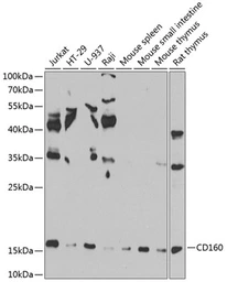 Anti-CD160 antibody used in Western Blot (WB). GTX55554