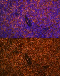 Anti-CD27 antibody used in IHC (Paraffin sections) (IHC-P). GTX55555