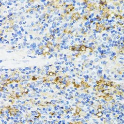 Anti-CD27 antibody used in IHC (Paraffin sections) (IHC-P). GTX55555