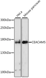 Anti-CD66e antibody used in Western Blot (WB). GTX55562