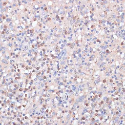 Anti-CD82 antibody used in IHC (Paraffin sections) (IHC-P). GTX55563