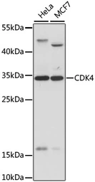 Anti-CDK4 antibody used in Western Blot (WB). GTX55565