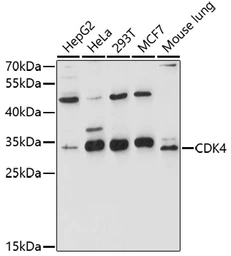 Anti-CDK4 antibody used in Western Blot (WB). GTX55565