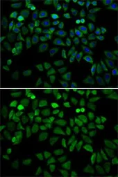 Anti-CDK4 antibody used in Immunocytochemistry/ Immunofluorescence (ICC/IF). GTX55565
