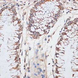 Anti-CDK4 antibody used in IHC (Paraffin sections) (IHC-P). GTX55565