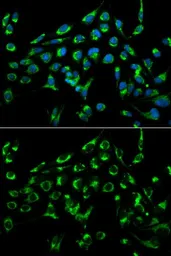 Anti-CDKN3 antibody used in Immunocytochemistry/ Immunofluorescence (ICC/IF). GTX55567