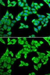 Anti-CIAPIN1 antibody used in Immunocytochemistry/ Immunofluorescence (ICC/IF). GTX55572
