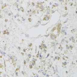 Anti-CIAPIN1 antibody used in IHC (Paraffin sections) (IHC-P). GTX55572