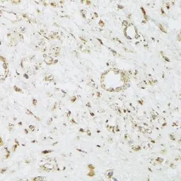 Anti-CIAPIN1 antibody used in IHC (Paraffin sections) (IHC-P). GTX55572