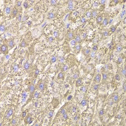 Anti-CIAPIN1 antibody used in IHC (Paraffin sections) (IHC-P). GTX55572