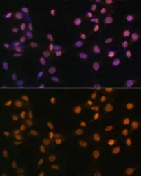 Anti-c-Jun antibody used in Immunocytochemistry/ Immunofluorescence (ICC/IF). GTX55573
