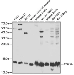 Anti-COX5A antibody used in Western Blot (WB). GTX55578