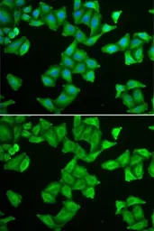 Anti-COX5A antibody used in Immunocytochemistry/ Immunofluorescence (ICC/IF). GTX55578
