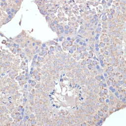 Anti-COX5A antibody used in IHC (Paraffin sections) (IHC-P). GTX55578