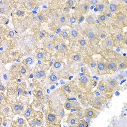 Anti-CRK antibody used in IHC (Paraffin sections) (IHC-P). GTX55580