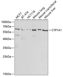 Anti-CYP1A1 antibody used in Western Blot (WB). GTX55582
