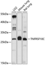 Anti-DcR1 antibody used in Western Blot (WB). GTX55586