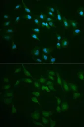 Anti-DNA ligase I antibody used in Immunocytochemistry/ Immunofluorescence (ICC/IF). GTX55590