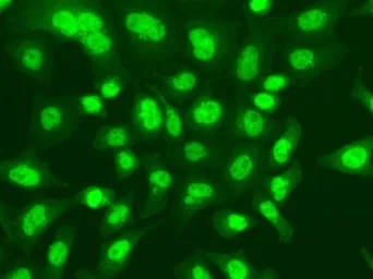 Anti-DNA ligase I antibody used in Immunocytochemistry/ Immunofluorescence (ICC/IF). GTX55590