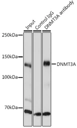 Anti-DNMT3A antibody used in Immunoprecipitation (IP). GTX55596