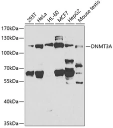 Anti-DNMT3A antibody used in Western Blot (WB). GTX55596