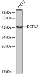 Anti-DCTN2 antibody used in Western Blot (WB). GTX55598