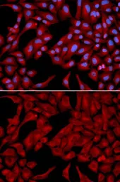 Anti-DCTN2 antibody used in Immunocytochemistry/ Immunofluorescence (ICC/IF). GTX55598
