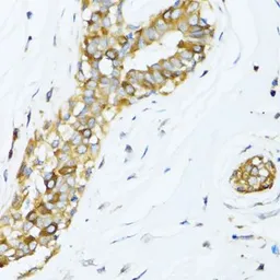 Anti-DCTN2 antibody used in IHC (Paraffin sections) (IHC-P). GTX55598