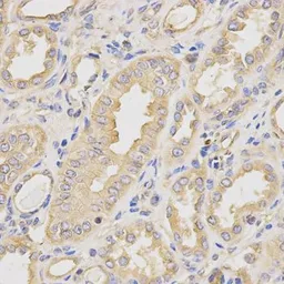 Anti-DCTN2 antibody used in IHC (Paraffin sections) (IHC-P). GTX55598