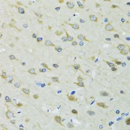 Anti-DCTN2 antibody used in IHC (Paraffin sections) (IHC-P). GTX55598