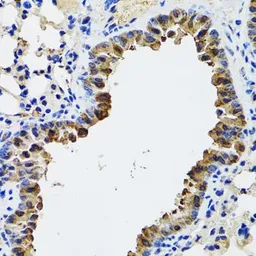 Anti-ESD antibody used in IHC (Paraffin sections) (IHC-P). GTX55610