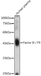 Anti-Factor IX antibody used in Western Blot (WB). GTX55612