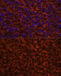 Anti-Factor IX antibody used in IHC (Paraffin sections) (IHC-P). GTX55612
