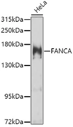 Anti-FANCA antibody used in Western Blot (WB). GTX55613