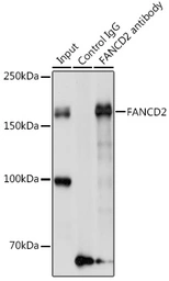Anti-FANCD2 antibody used in Immunoprecipitation (IP). GTX55614