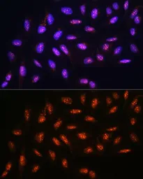 Anti-FANCD2 antibody used in Immunocytochemistry/ Immunofluorescence (ICC/IF). GTX55614