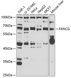 Anti-FANCG antibody used in Western Blot (WB). GTX55615