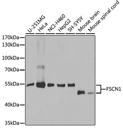 Anti-Fascin 1 antibody used in Western Blot (WB). GTX55616