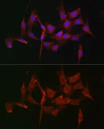 Anti-Fascin 1 antibody used in Immunocytochemistry/ Immunofluorescence (ICC/IF). GTX55616