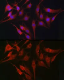 Anti-Fascin 1 antibody used in Immunocytochemistry/ Immunofluorescence (ICC/IF). GTX55616