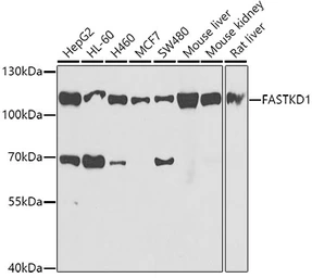 Anti-FASTKD1 antibody used in Western Blot (WB). GTX55617