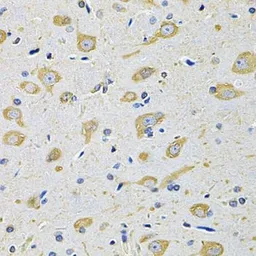 Anti-FASTKD1 antibody used in IHC (Paraffin sections) (IHC-P). GTX55617