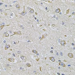 Anti-FASTKD1 antibody used in IHC (Paraffin sections) (IHC-P). GTX55617
