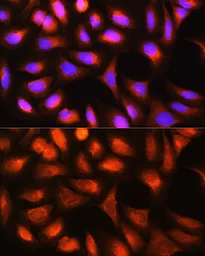 Anti-Ferritin Light Chain antibody used in Immunocytochemistry/ Immunofluorescence (ICC/IF). GTX55618