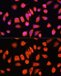 Anti-Ferritin Light Chain antibody used in Immunocytochemistry/ Immunofluorescence (ICC/IF). GTX55618