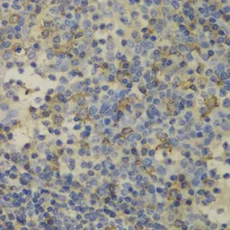 Anti-Ferritin Light Chain antibody used in IHC (Paraffin sections) (IHC-P). GTX55618