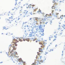 Anti-FGF10 antibody used in IHC (Paraffin sections) (IHC-P). GTX55619